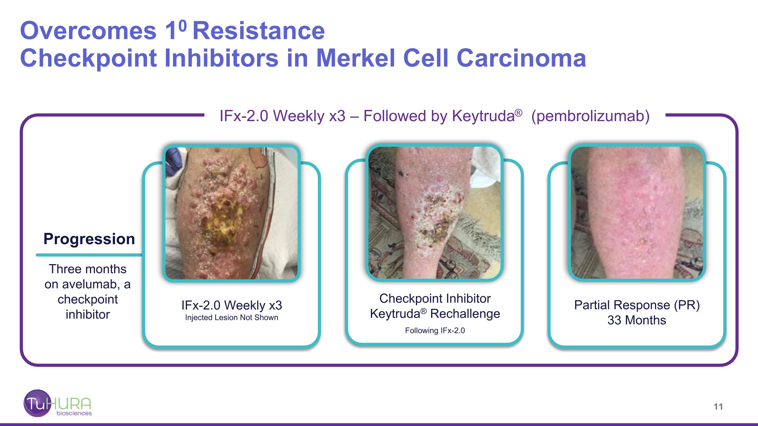 Slide 11